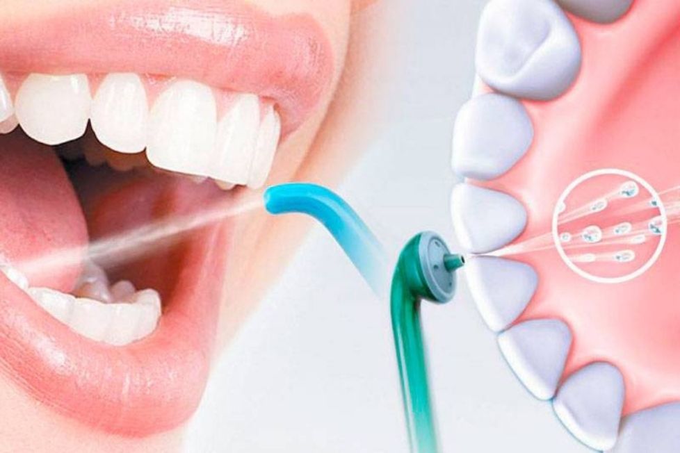 Снятие мягкого зубного налета при помощи метода AirFlow