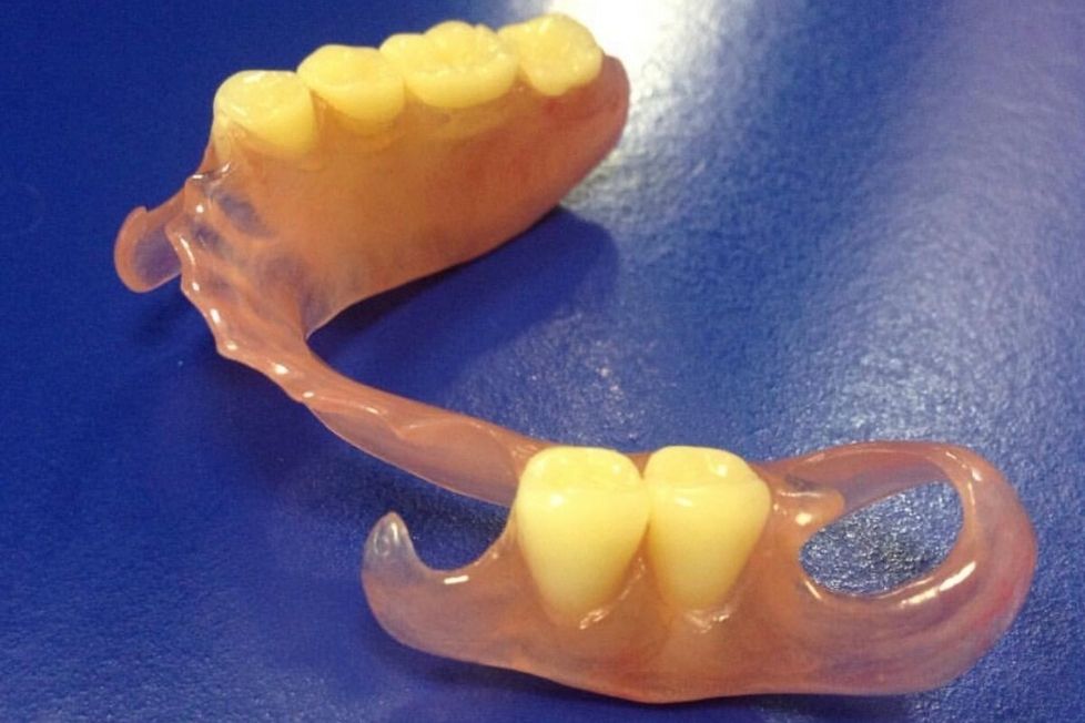 Бюгельные зубные протезы